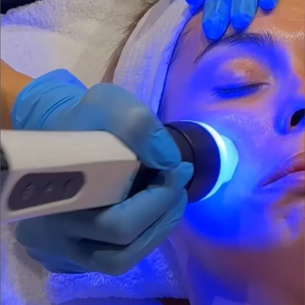 Mesoterapia Virtual